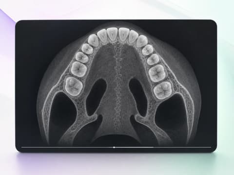 Lienzo editorial oscuro con un corte axial CBCT del maxilar del caso TL-8264