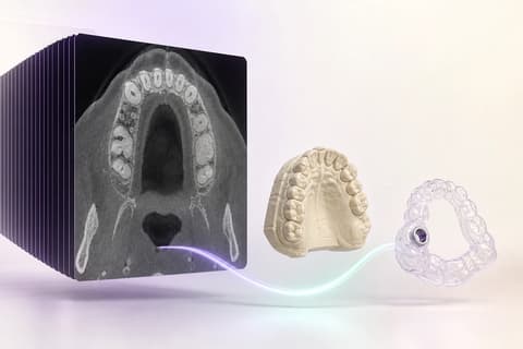 Estudio DICOM, modelo maxilar y guía transparente representados como objetos separados del mismo caso