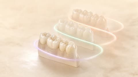 Tres segmentos dentales posteriores relacionados por una cinta luminosa de procedencia del mismo caso