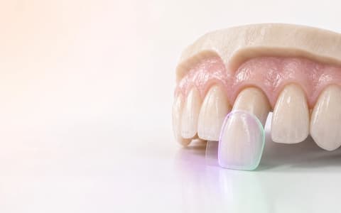 Versión V03 de una corona anterior aceptada por el laboratorio después de una aclaración documentada