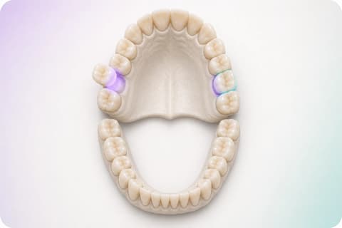 Visualización editorial de un odontograma adulto completo con varios sitios de tratamiento