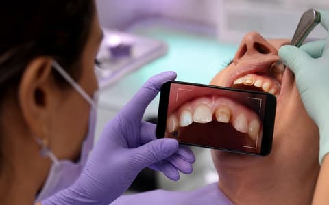 TrazaCaptura guiando una fotografía de preparación anterior desde el teléfono