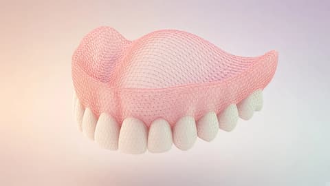 A vertex-colored upper-arch mesh with one open rim
