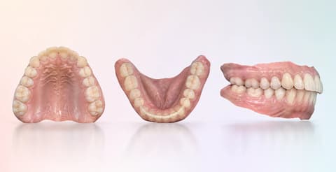 Synthetic treatment arch, antagonist, and bite relationship shown by function