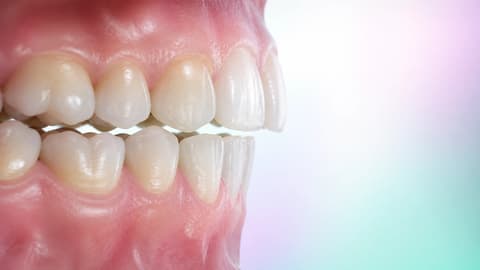 Synthetic occlusal relationship explaining the case functional geometry