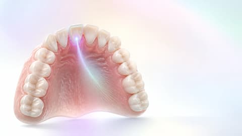 Synthetic upper arch with a single incisor highlighted as the stable origin of the case
