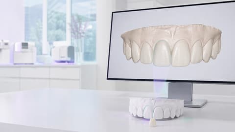 Synthetic dental case visible on a monitor and on a laboratory model of the same site