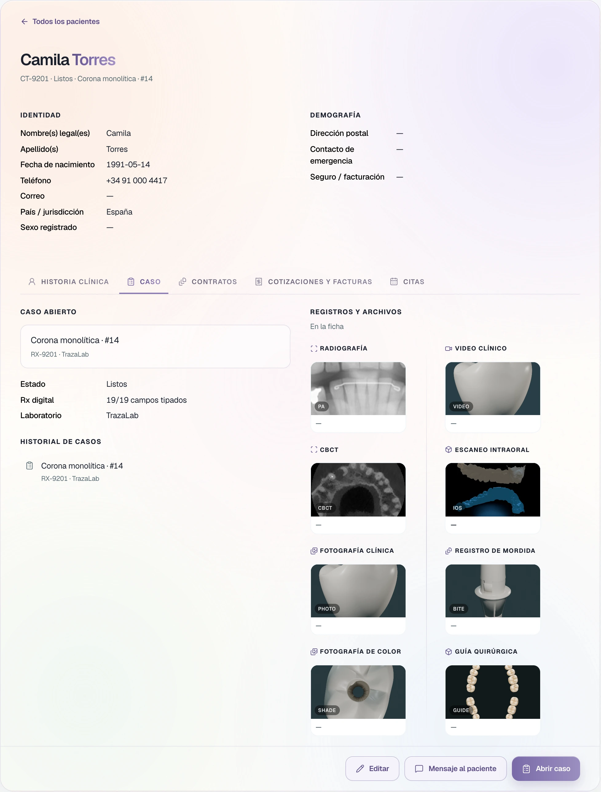 Camila Torres's record on the Case tab, with Spain as the country: monolithic crown on tooth 14, RX-9201, and the records on the chart.