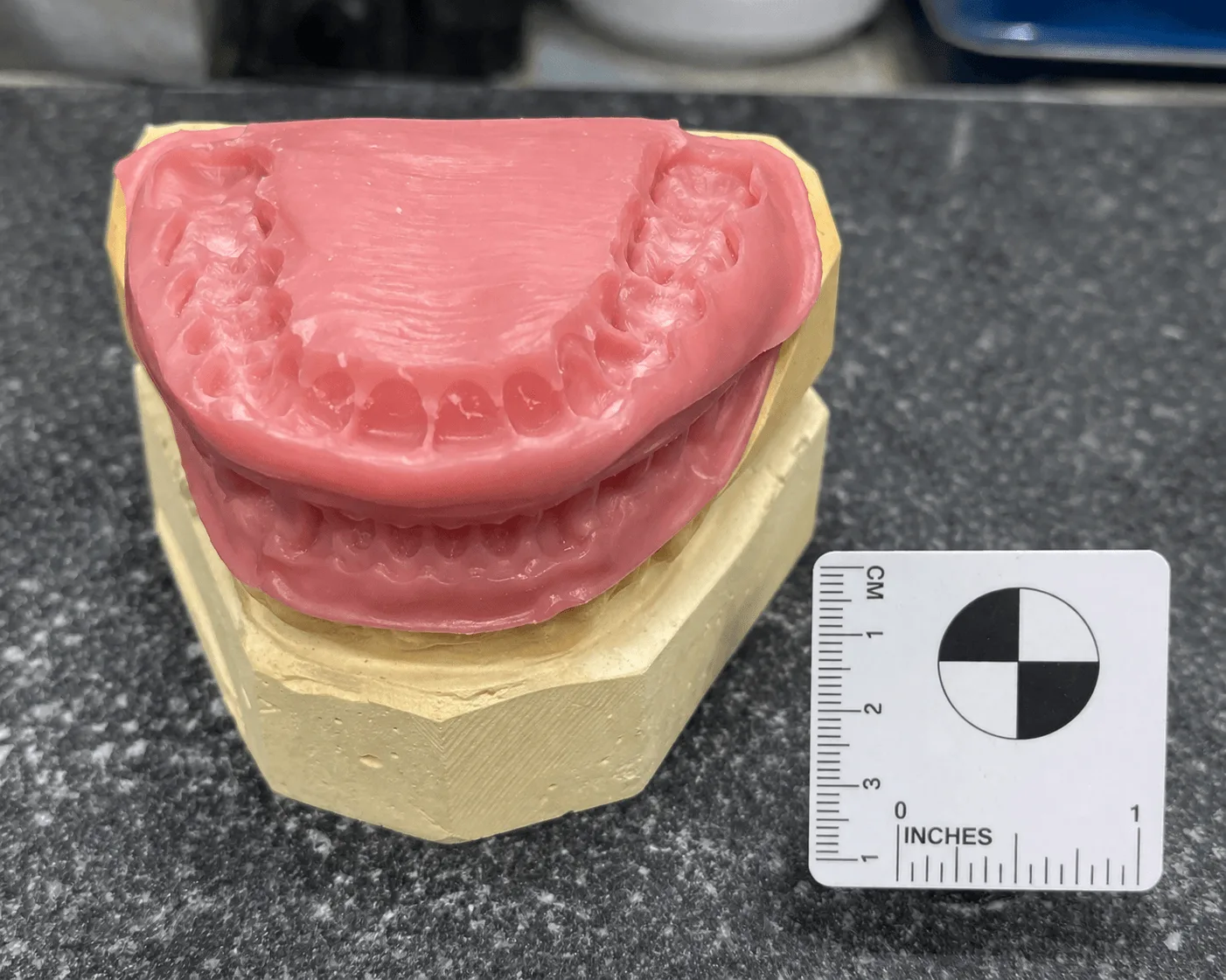 Registro oclusal