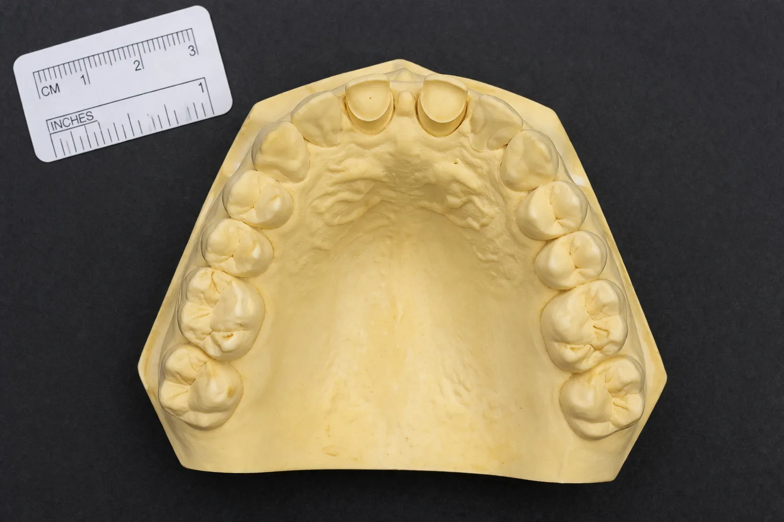 Vista oclusal