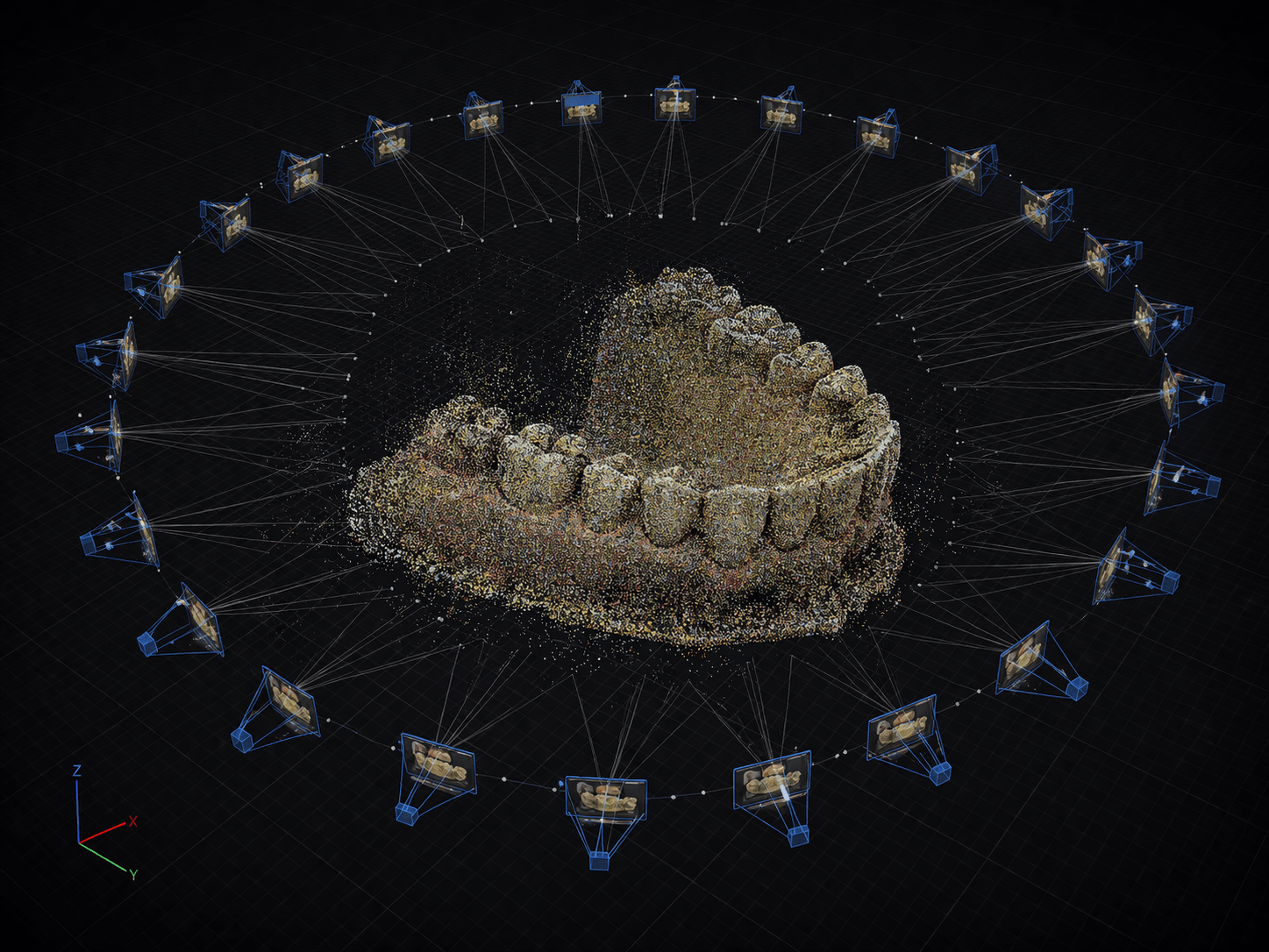 Deteccion de features SIFT en fotografia dental