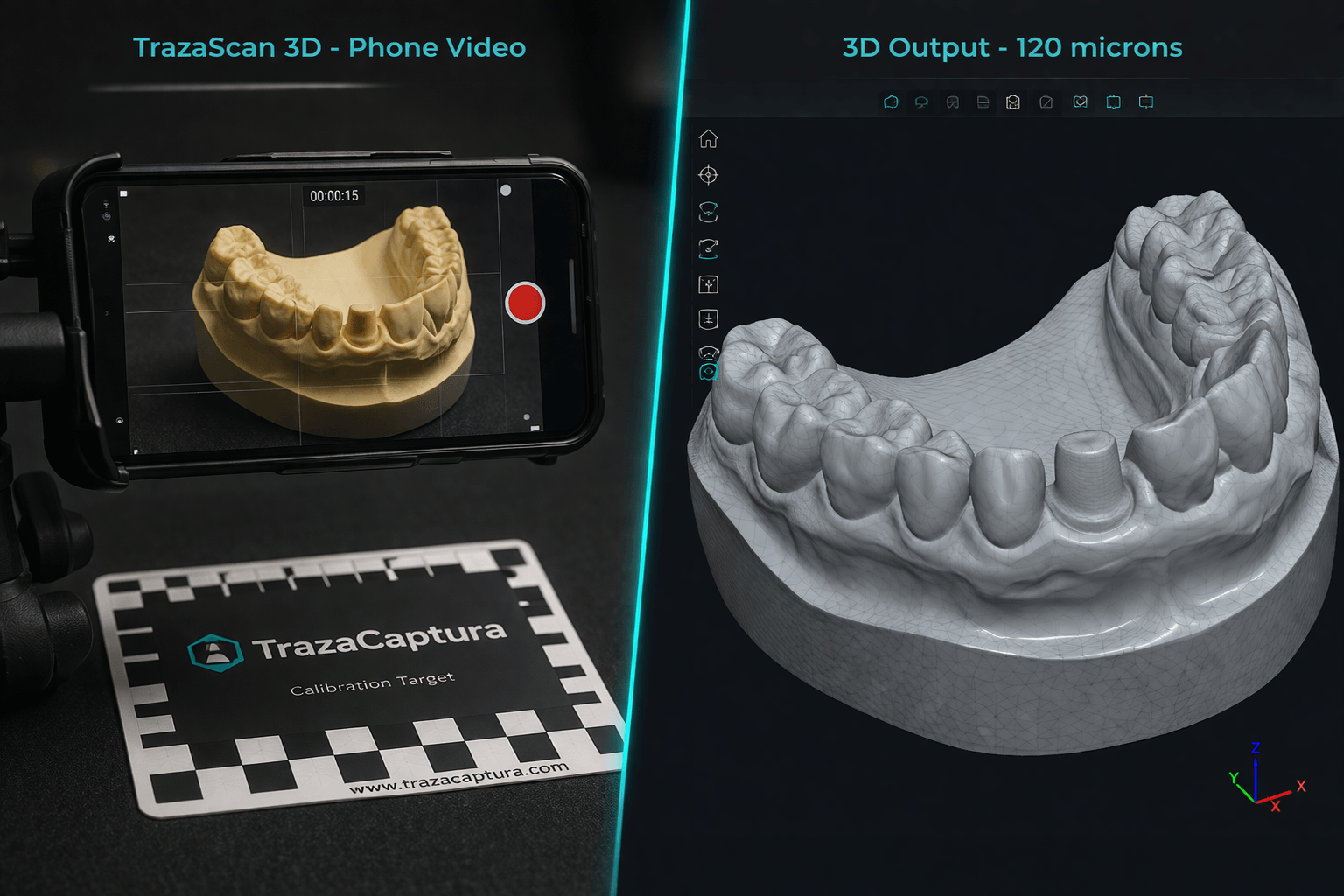 Frames extraidos del video dental