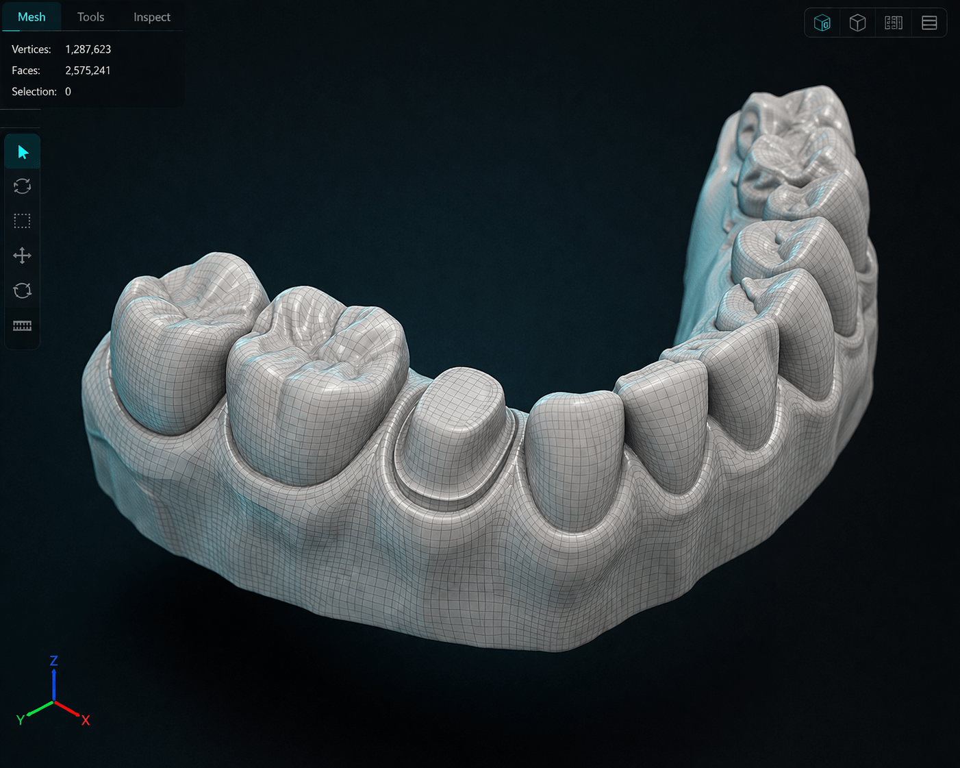 Nube de puntos densa de modelo dental