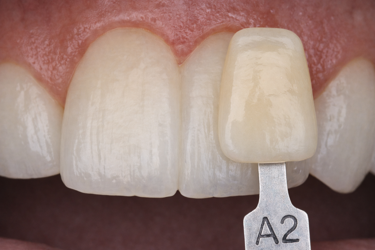 Acercamiento con 3 zonas visibles