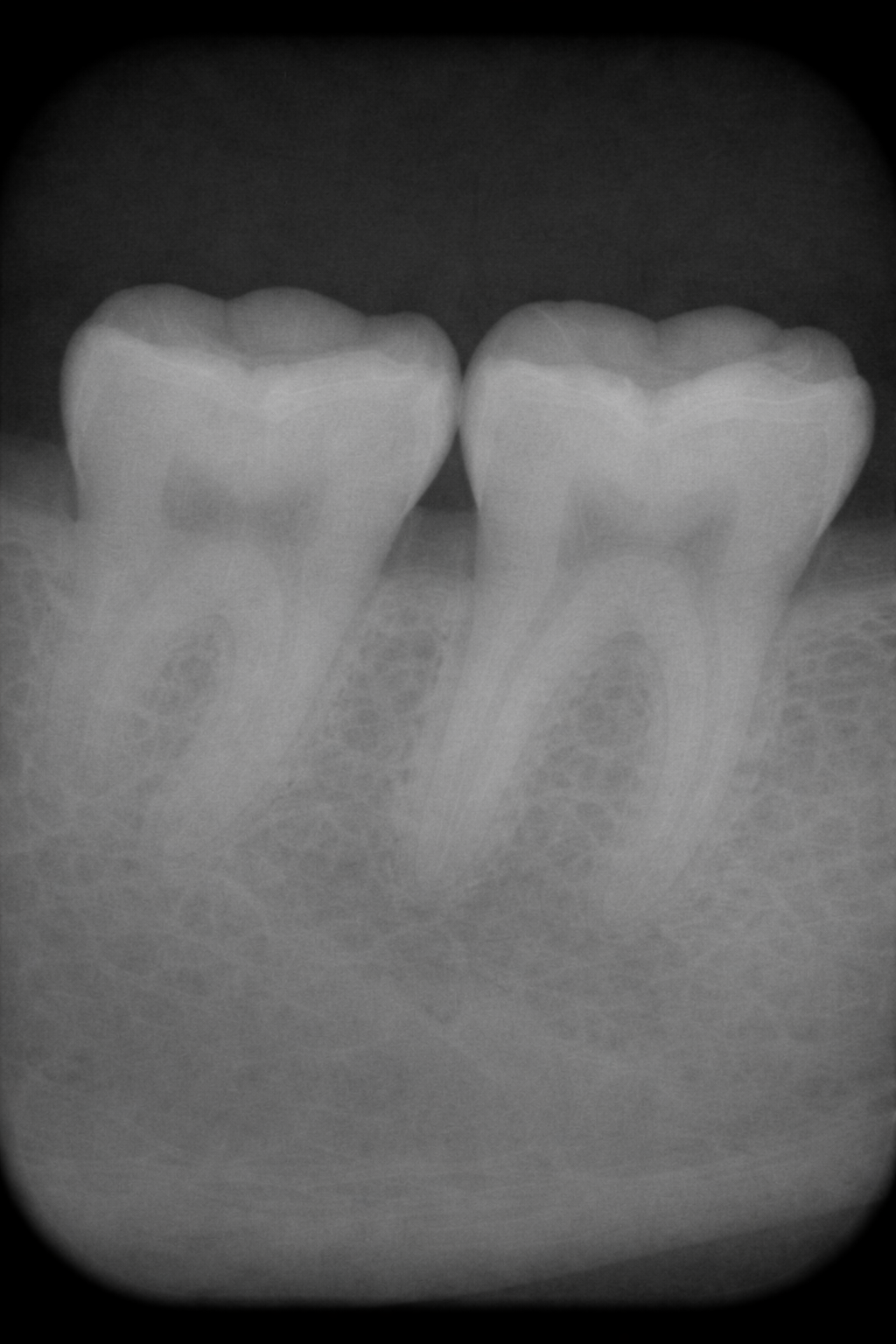 Original radiograph