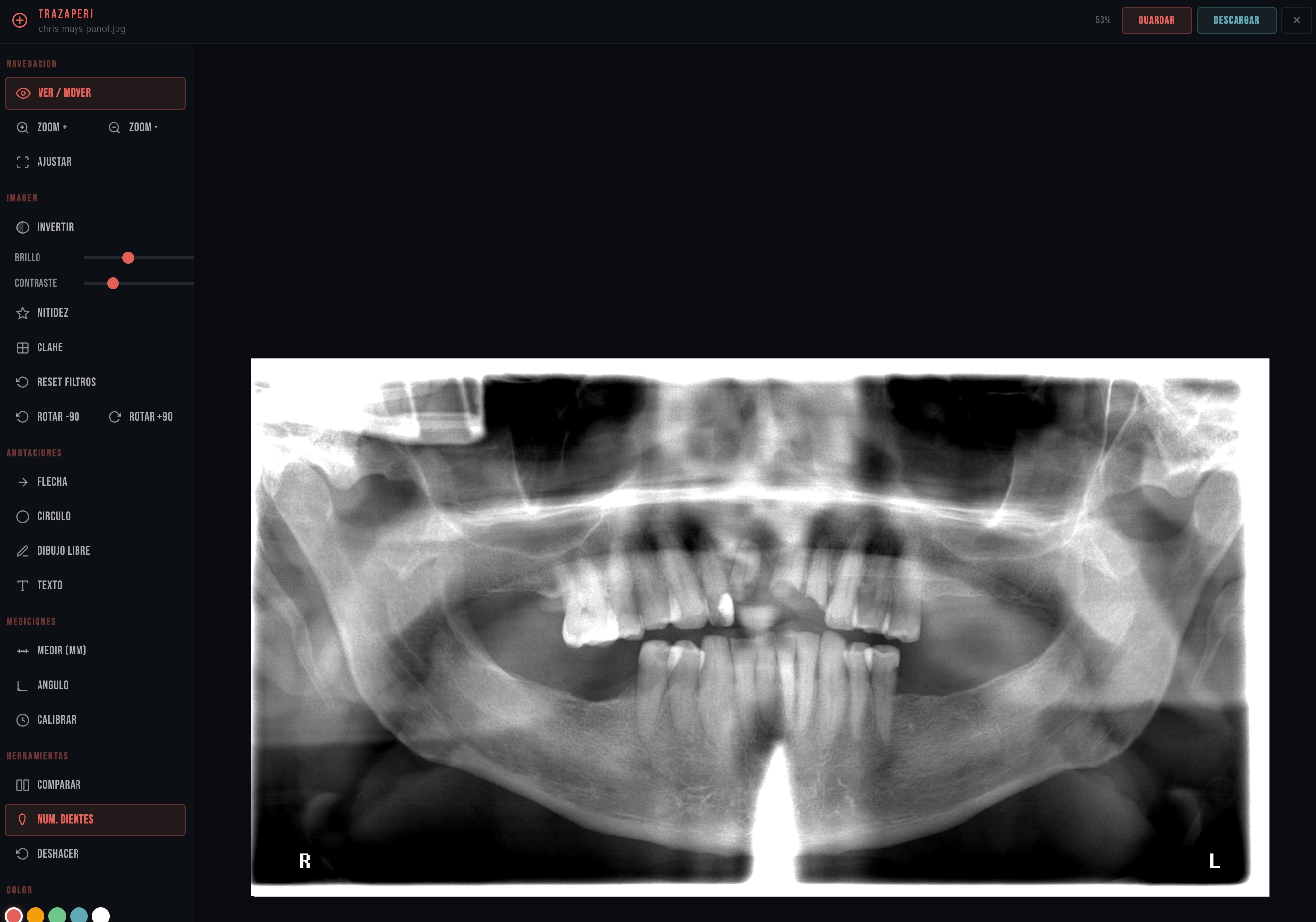 TrazaPeri — Visor periapical profesional